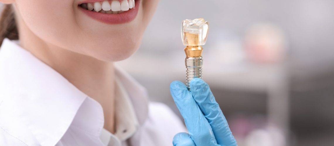 Dentist holding educational model of dental implant indoors, closeup